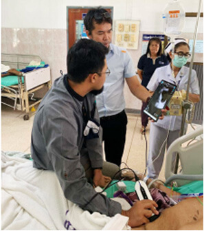 CHISON SonoEye en Filipinas