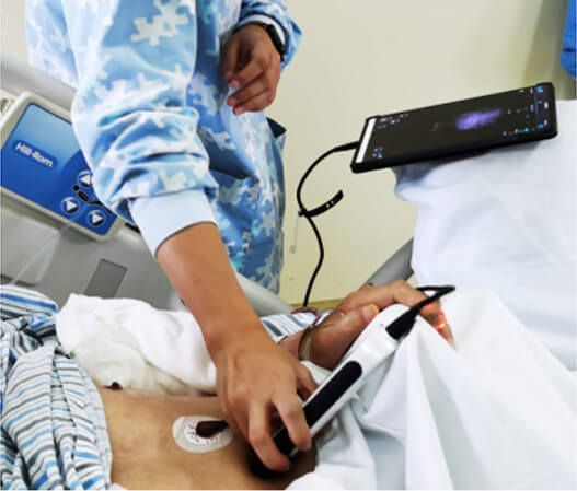 CHISON SonoEye en Asia CHISON SonoEye en Asia