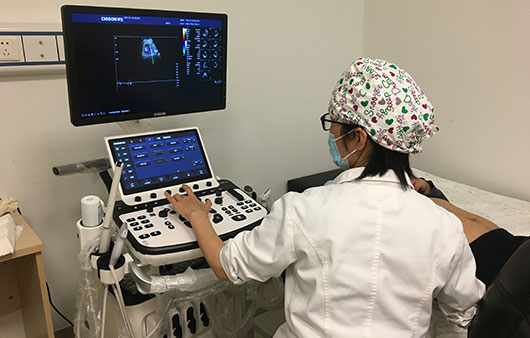 CHISON XBit en China CHISON XBit en China