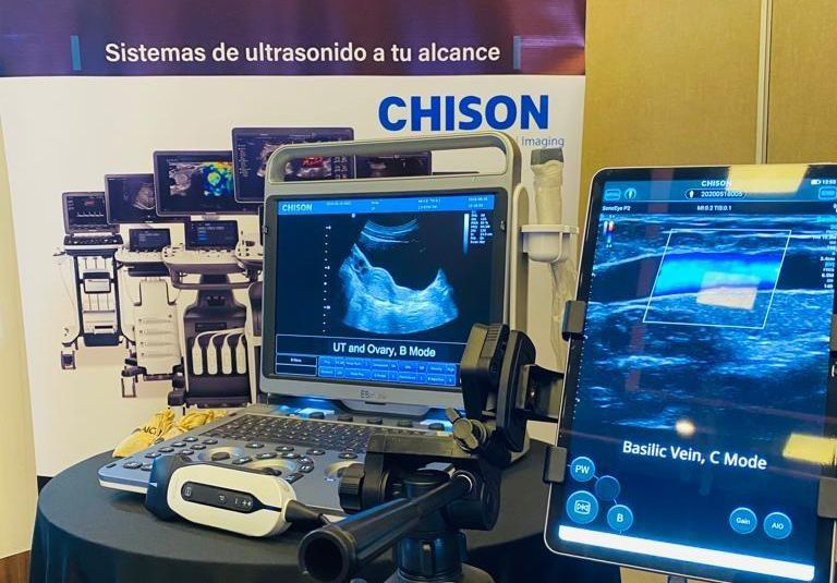 The Chison has automatic measurement of intima-media thickness to speed up carotid examinations, a scan assistant feature to minimize keystrokes and automatic optimization for better contrast resolution.