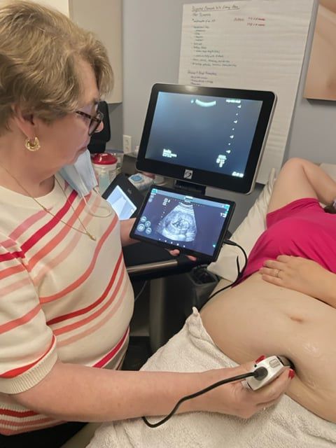 Fetal hearts can be easily identified and survival confirmed by heart motion using Chison ultrasound machines 