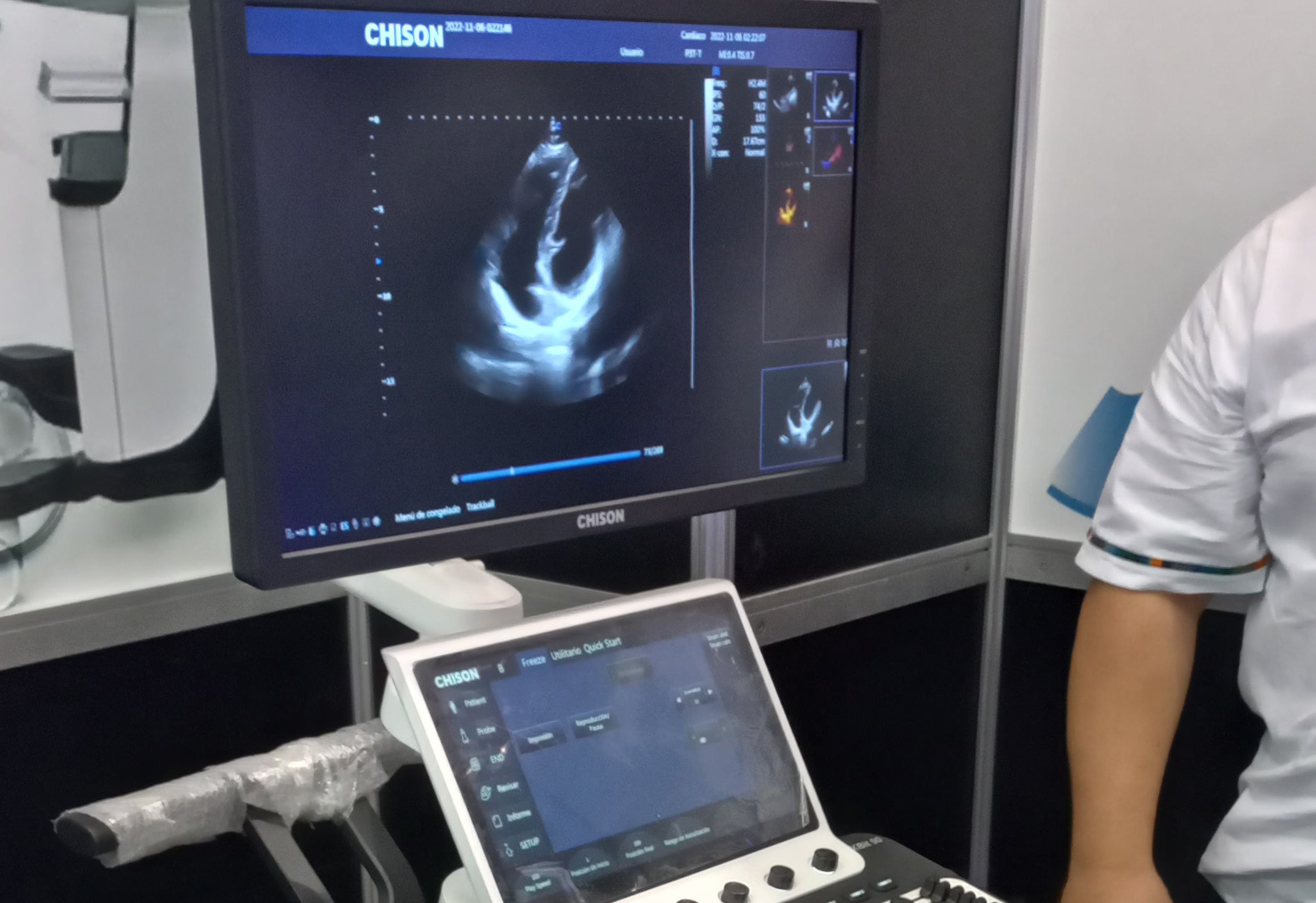 A wide range of cardiac department probes allows for scanning of every type of patient, and even pediatric and neonatal cardiology is seeing rapid growth in probes built for these small patients