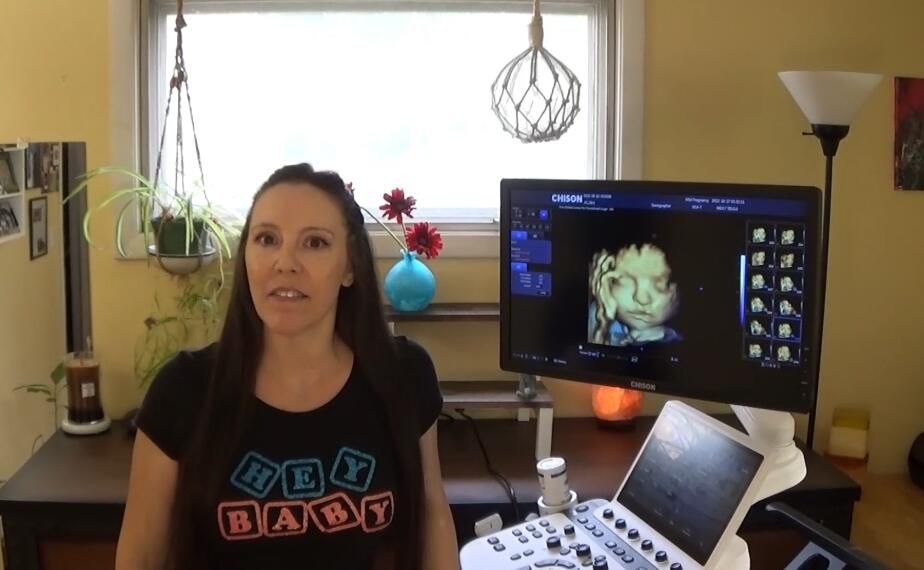 Another important feature of 3D ultrasound machines is spatial compounding, which combines multiple 2D images to create a 3D image.