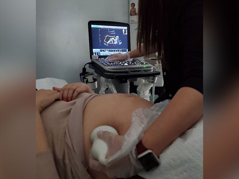 A portable 3D ultrasound machine is a type of medical imaging equipment that is designed to be compact and lightweight, making it easy to transport and use in a variety of settings. 