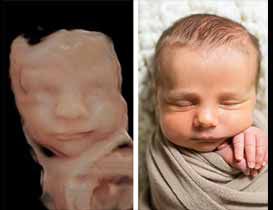 One of the main advantages of a portable 3D ultrasound machine is its ability to be used in a variety of settings, such as in a hospital, clinic, or even in remote or hard-to-reach locations. T